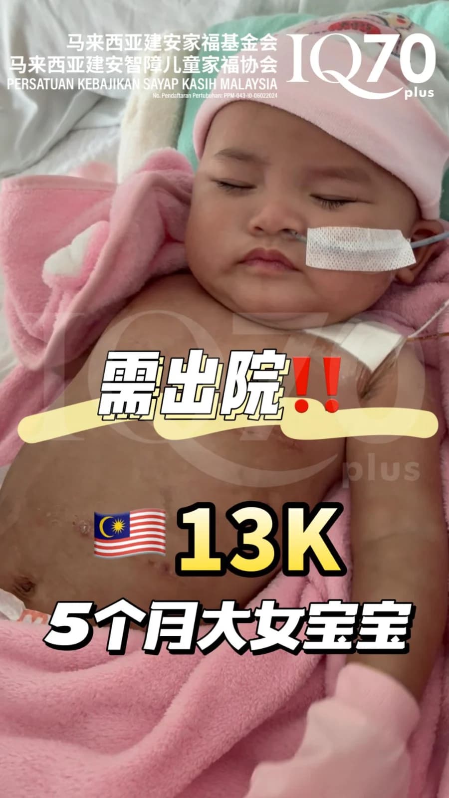 5个月大的 Julia,需要 RM13,725 医疗援助,盼顺利出院