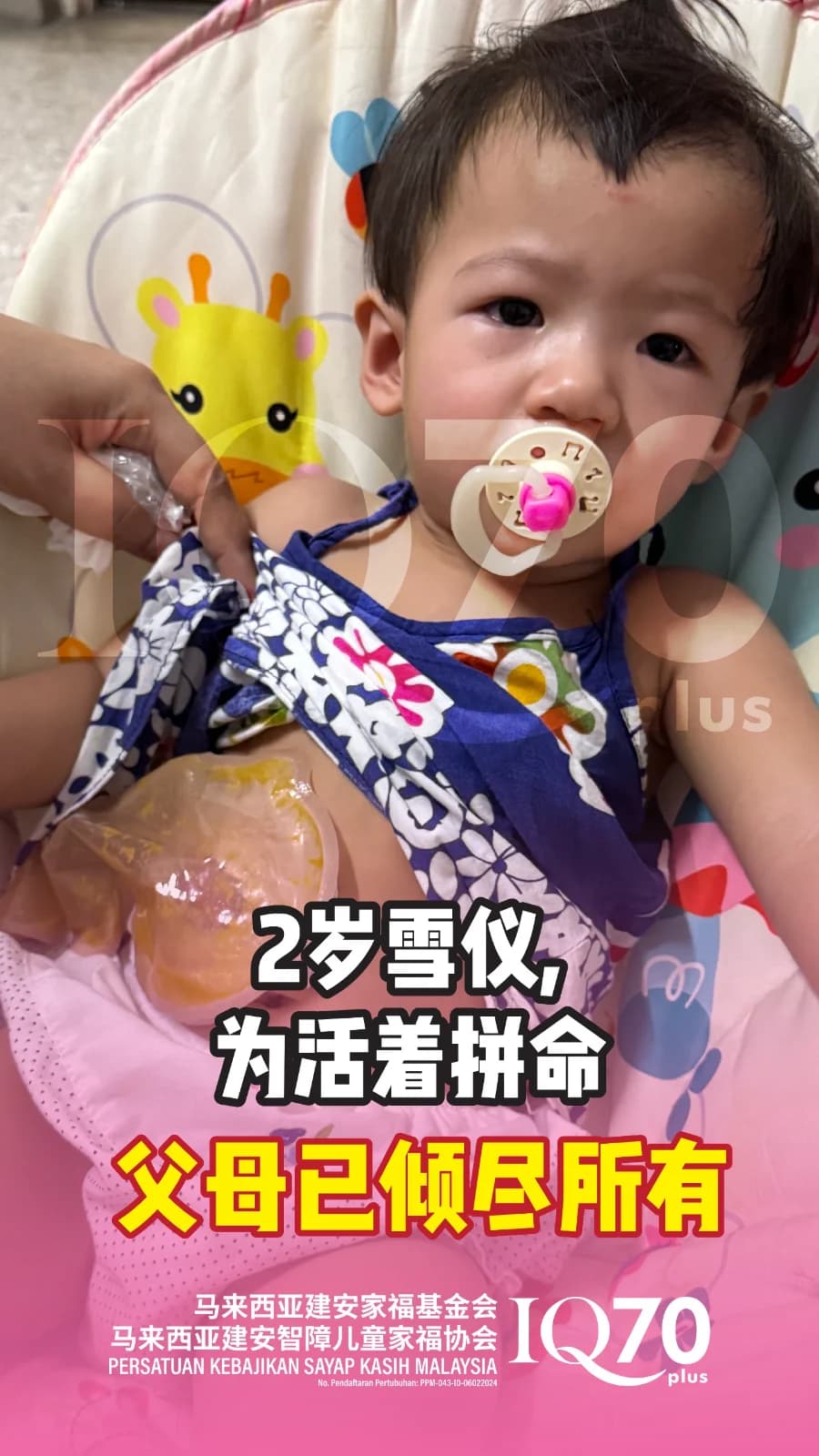 Urgently Raising RM31,507 for Shwe Yi's Reconstructive Surgery